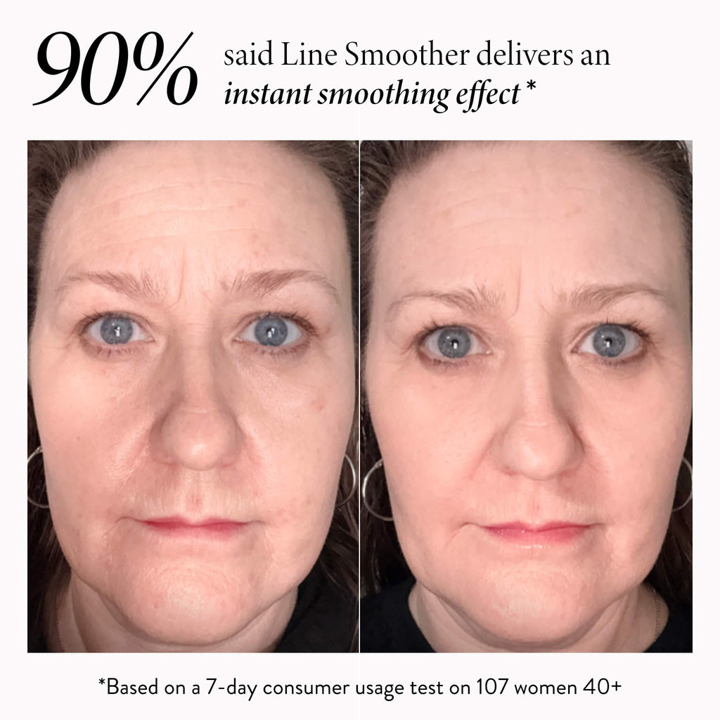 Line Smoother Full Face Kit (3PC)